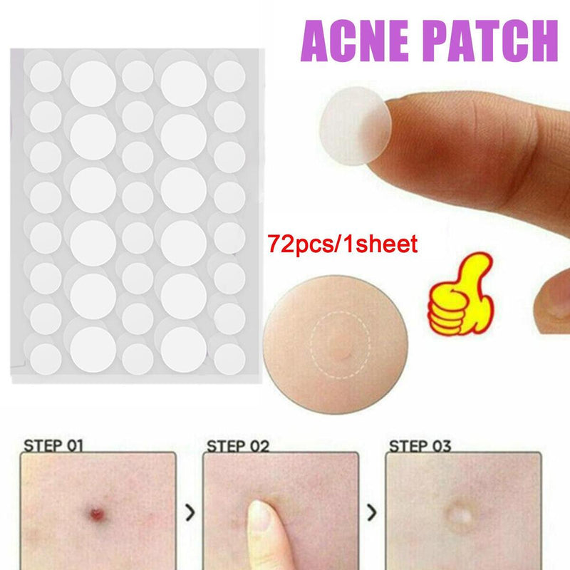 72pcs Skin Tag Remover Patches Hydrocolloid Acne Pimple Wart Remover Plaster.