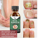 Fungal Nail Repair Essence Care Treatment Whitening Foot Nail Gel T6W5