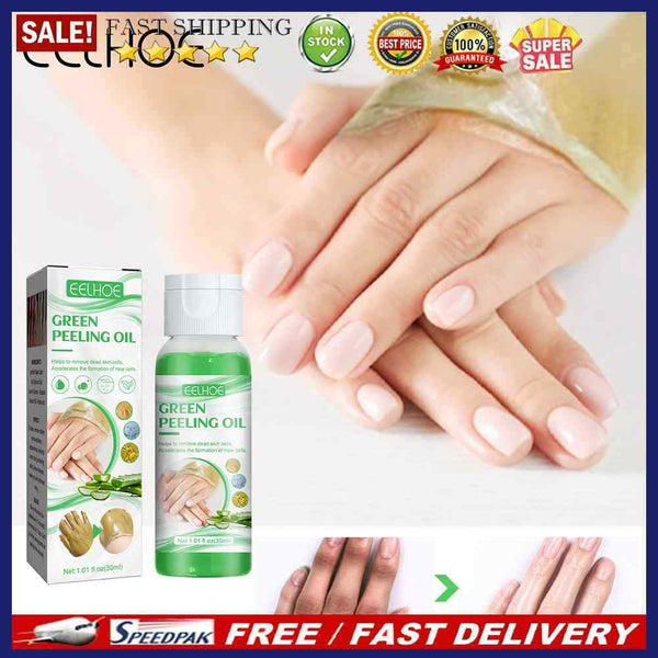 30ml Peeling Oil Lightening Acne Dark Patches Peeling Lotion Oil for Knee Ankle