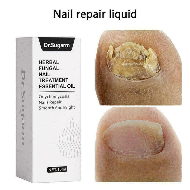 Nail Fungus Treatment Nail Oil Pen Anti Fungal Nail Remove Q4Y8 L0J1 C8K4