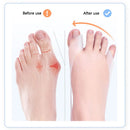 1pair Toe Thumb Orthotics Non-slip Toe Eversion Adjustment Bands Foot Care Tools