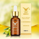 Essential oils For Stretch Marks Remover Strong Strength S5V5 Mark Removes U4T7