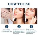 Lift Thread Chin Lift Thread Face Lifting Thread Collagen Silk Thread
