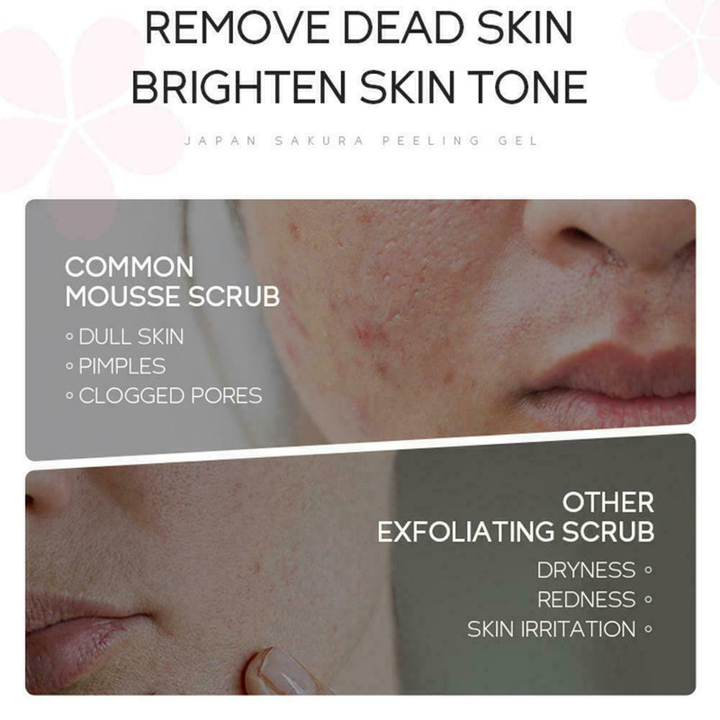 Deep Cleansing Exfoliating Peeling Gel Facial Scrub Smooth Cleanser 60g Q7Z6