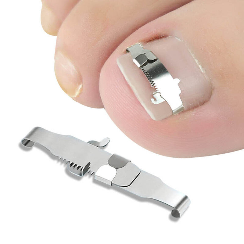 Stainless Steel Ingrown Toe Nail Fixer Pedicure Treatment Recover Embed Tool