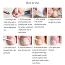 Ingrown Toenail Straightening Clip+Glue+Polish File Curved Brace Patch Kit