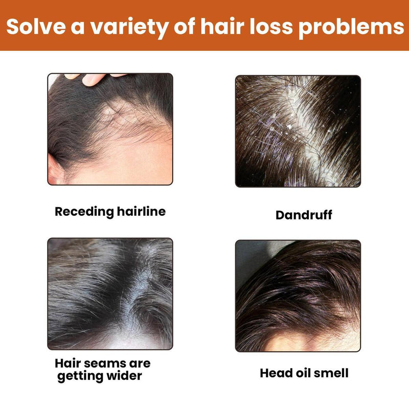 Instant Hair Regrowth Shampoo Hair loss Prevention Shampoo Anti Hairs Loss{