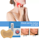 7x Thyroid Stickers Portable Lymph Drainage Node Effective Heating Neck Patches