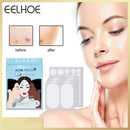 80pcs Acne Patches Pimple Remover Invisible Spot Stickers Facial Care Beauty