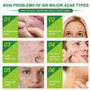 24 Pcs Skin Tag Remover Pimple Master Patch Treatment U2K7 Acne Stickers K0D4