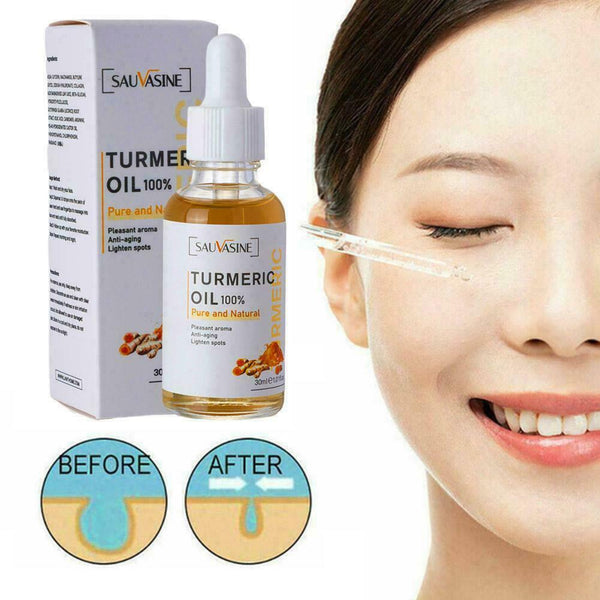 Turmeric Oil Skin Acne Clear Skin Dark Spot Corrector Whitening Serum Face 30ml