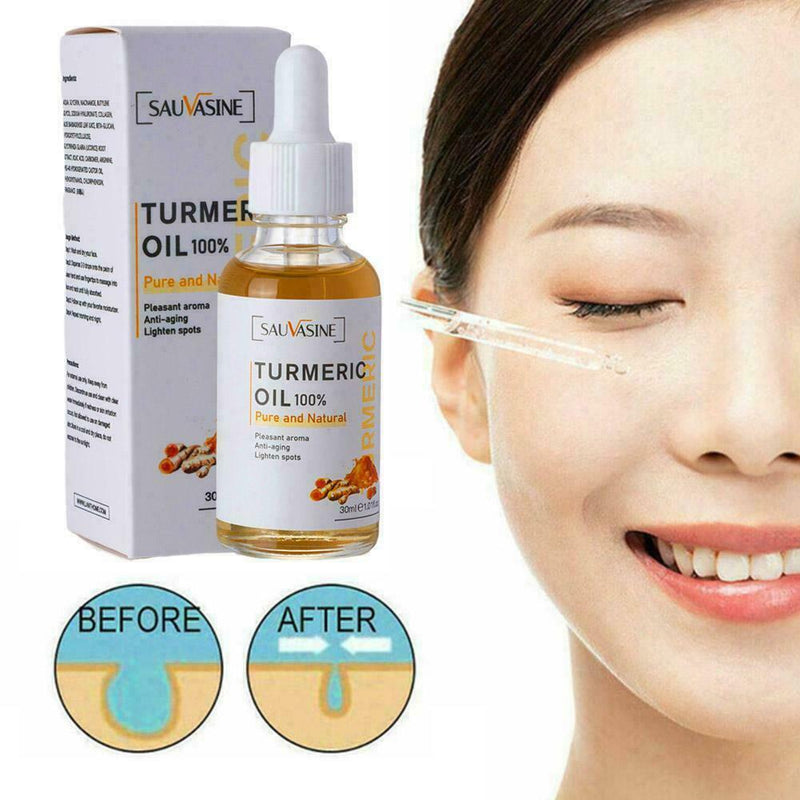 Turmeric Oil Skin Acne Clear Skin Dark Spot Corrector Whitening Serum Face 30ml