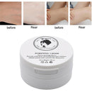 Dark Skin Bleaching Creme Whitening Lightening - Knie und Ellbogen 15g.