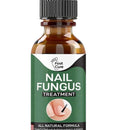Nail Fungus Treatment Whitening Toe Anti Infection Nails Essence (50ml)