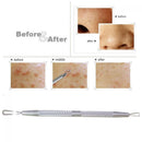 Extractor Comedone Stainless Steel Pimple Needles Blackhead Remover Tool
