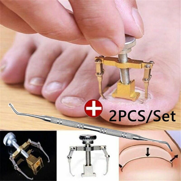 Effective Foot Care Pedicure Tools Set Ingrown Toenail Correction Paronychia