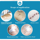 Medical Waterproof Surgical Adhesive PU Film Wound Dressing Fixation Sticker_