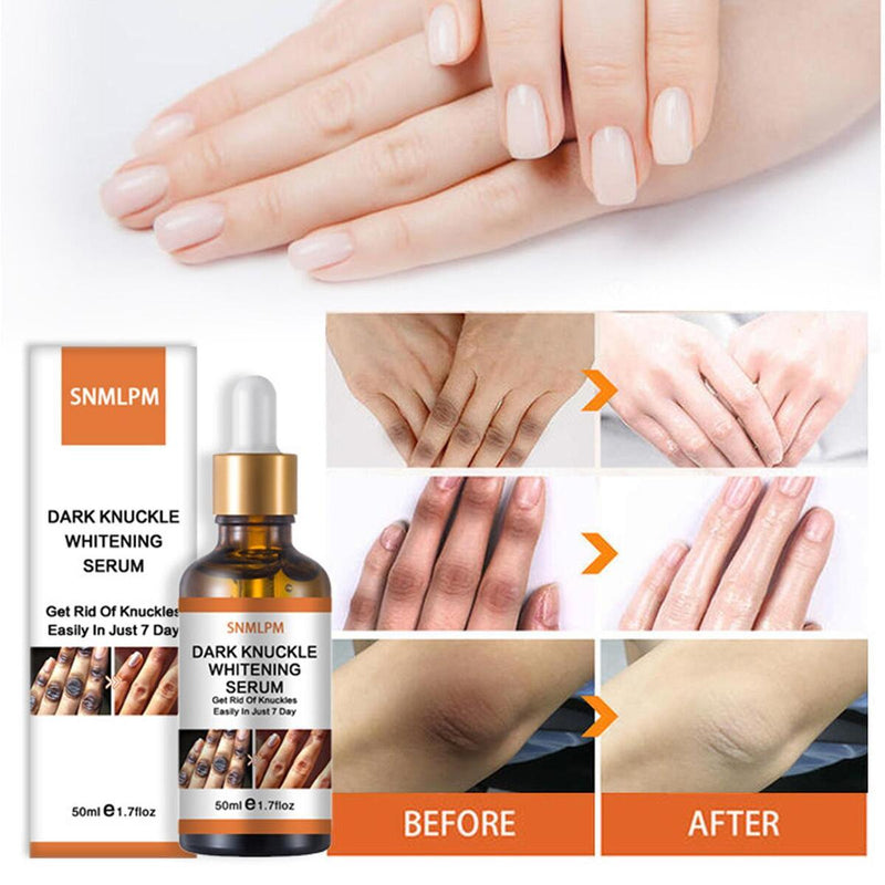 Serum Whitening Removing Dark Knuckles Serum Hand knuckle Eraser Serum Elbow`