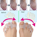 Align Toes Orthotics Foot Care Tools Bunion Corrector  Silicone Toe Separator