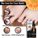 Nail Repair Fluid Health Care Foot Treatment Onychomycosis Paronychia Impro