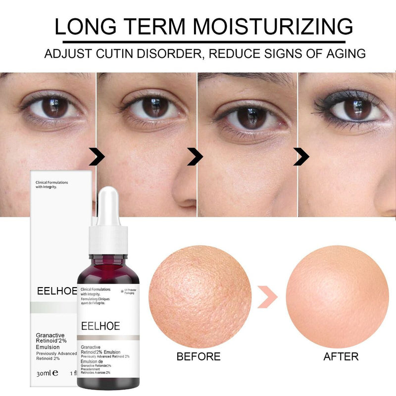 Exfoliating Pores Repair Fruit Acid Shrink Pores Skin Care Salicylic Acid