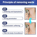 Skin Tag Remover Patches Acne Pimple Moles Wart Remover 144 Pcs`