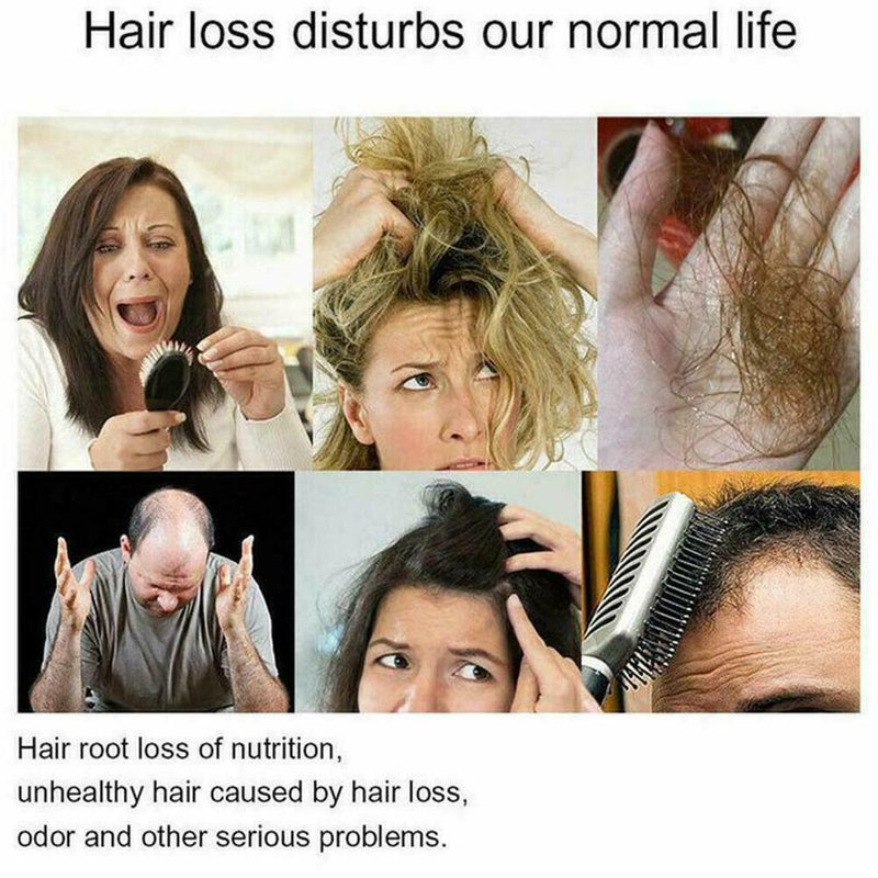 250ml Polygonum Shampoo Ginger Bar Moisturizing Refreshing Hair Control Oil D4G0