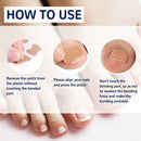 Ingrown Toenail Treatment Correction Stickers Pedicure Nail Care Tool for Unisex
