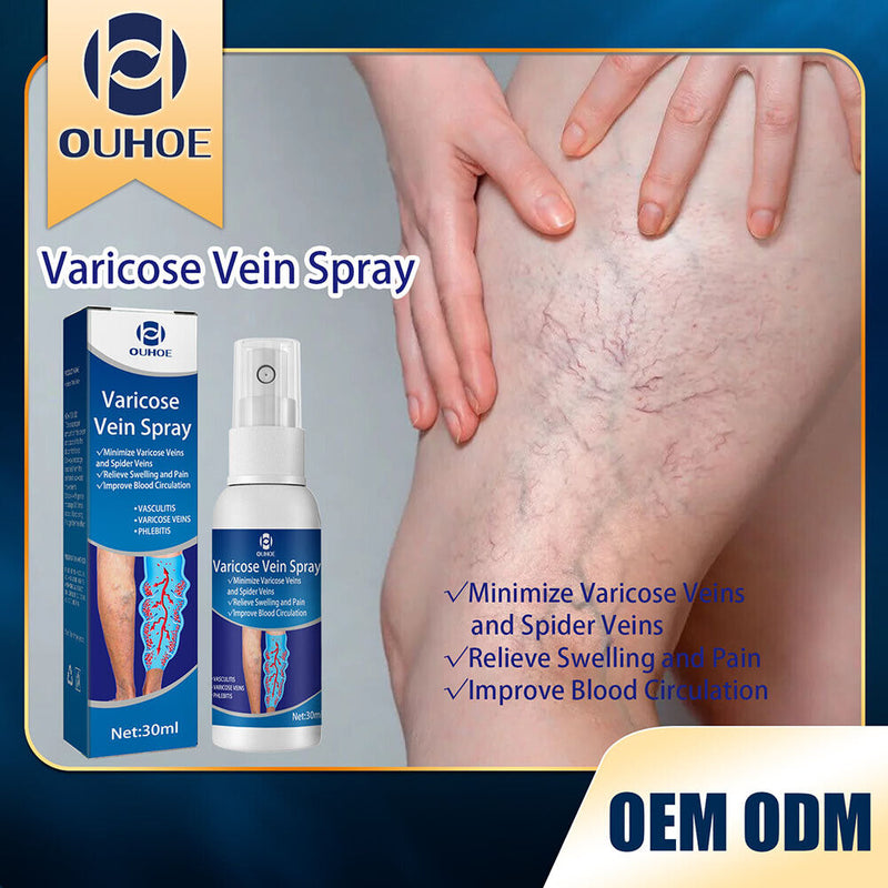 Varicose Vein Spray Improve Blood Circulation Soothing Leg Acid Bilges Itch