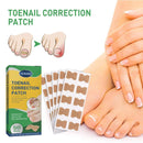 Ingrown Toenail Correction Stickers Nail Corrector Patches Nail Care Tool!