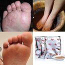 Foot Bath Powder Anti Beriberi Feet Care Athlete's 7Y6T Z0O0 Tinea Foot, U4A0