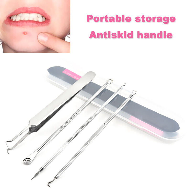 4pcs Blackhead Remover Acne Needles Metal Spoon Facial Black Spot Pore Extractor