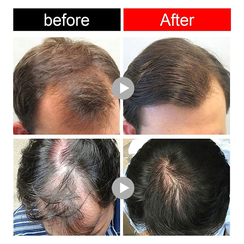 Essential Oil Fermented Rice Water Serum Nourishing Hair Repair Damaged Hair