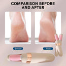 Electric Foot File Grinder Dead Hard Skin Callus Remover Feet Pedicure Tool New_