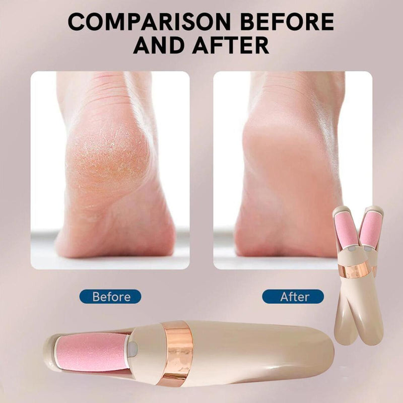 Electric Foot File Grinder Dead Hard Skin Callus Remover Feet Pedicure Tool New_