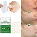 36 Patches Waterproof Acne Pimple Patch Stickers Acne FAST Pimple Remover H8K1