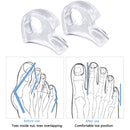 Silicone Feet Protector Bunion Corrector Hallux Valgus for Feet Care Pedicure