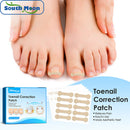 Nail Correction Stickers Waterproof Nail Treatment Pedicure Tools for Paronychia