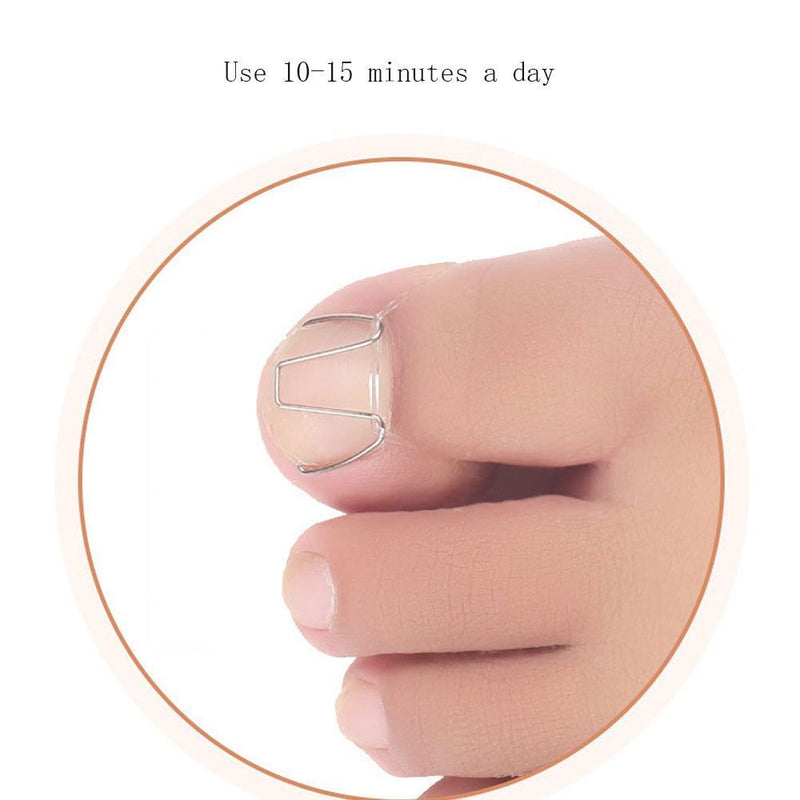 Easy To Use Pedicure Correct Multiple Front Hook Toenails Orthotics Rubber Band