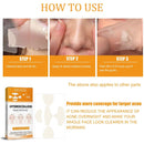 Tag Remover Patch Ance Pimple Patches Acne Spot Treatment Hydrocolloid Master