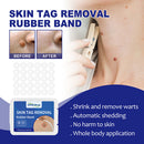 Rubber Skin Tag Remover Device Painless Safe Easy To Use Face Care Beauty Tools