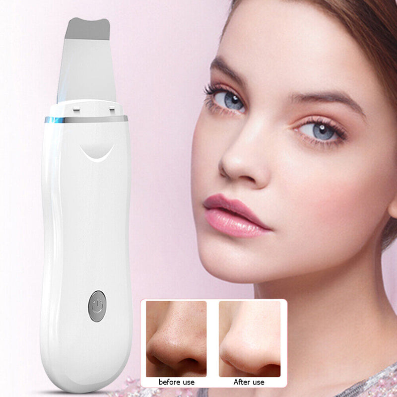 Massager Skin Scrubber Cleaner Ultrasonic Blackhead Exfoliating Exfoliating Spatula