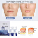 7pcs 2ml Collagen Serum for Face Anti Wrinkles Whitening Hydrating Essence