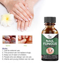 Nail Fungus Treatment Whitening Toe Anti Infection Nails Essence (10ml)