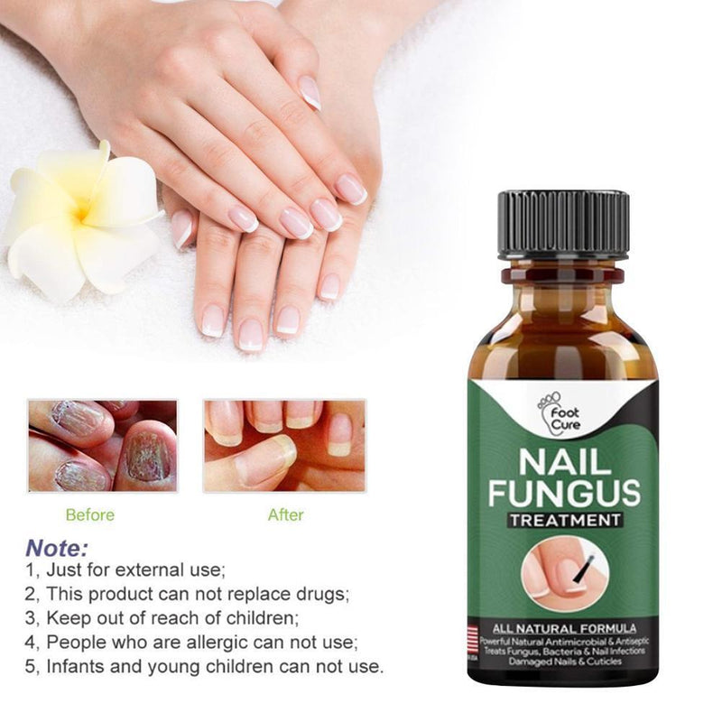 Nail Fungus Treatment Whitening Toe Anti Infection Nails Essence (10ml)