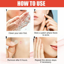 Master Ance Pimple Patches Acne Spot Treatment Skin Tag Remover Patch