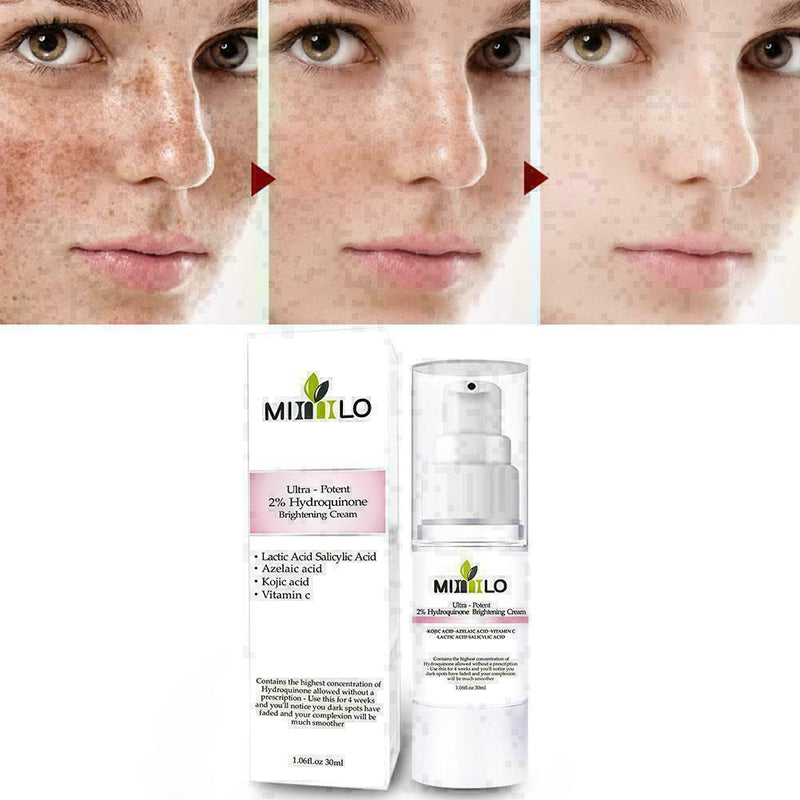 Brightens Skin 30ml Skin Fades Spots Freckles Yellow L8E3 Dark Q1L4 F5P9 W4S5