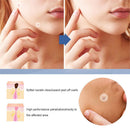 Anti Verruca Remedy Acne Spot Treatment Warts Remover Patch Skin Tag Remover