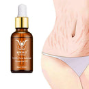 Stretch Marks Remover Essential Oil Eliminate Pregnancy Scars Maternity X7Y9