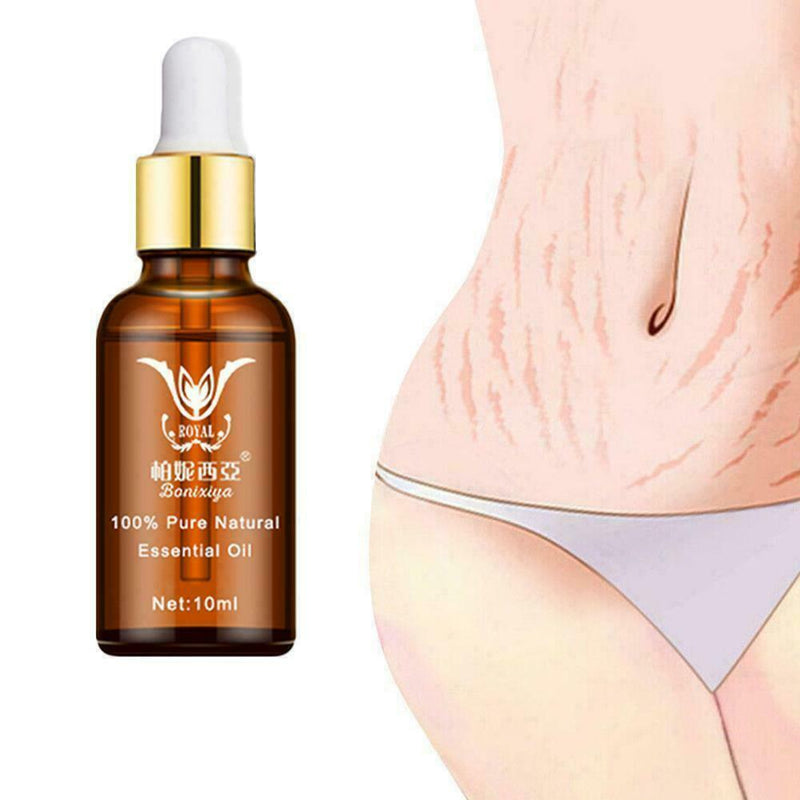 Stretch Marks Remover Essential Oil Eliminate Pregnancy Scars Maternity X7Y9